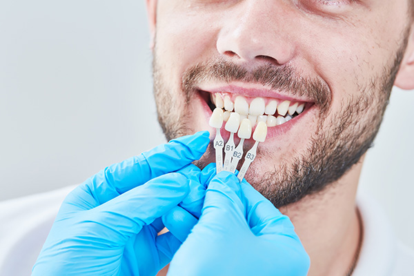 How Dental Veneers Are Used In General Dentistry